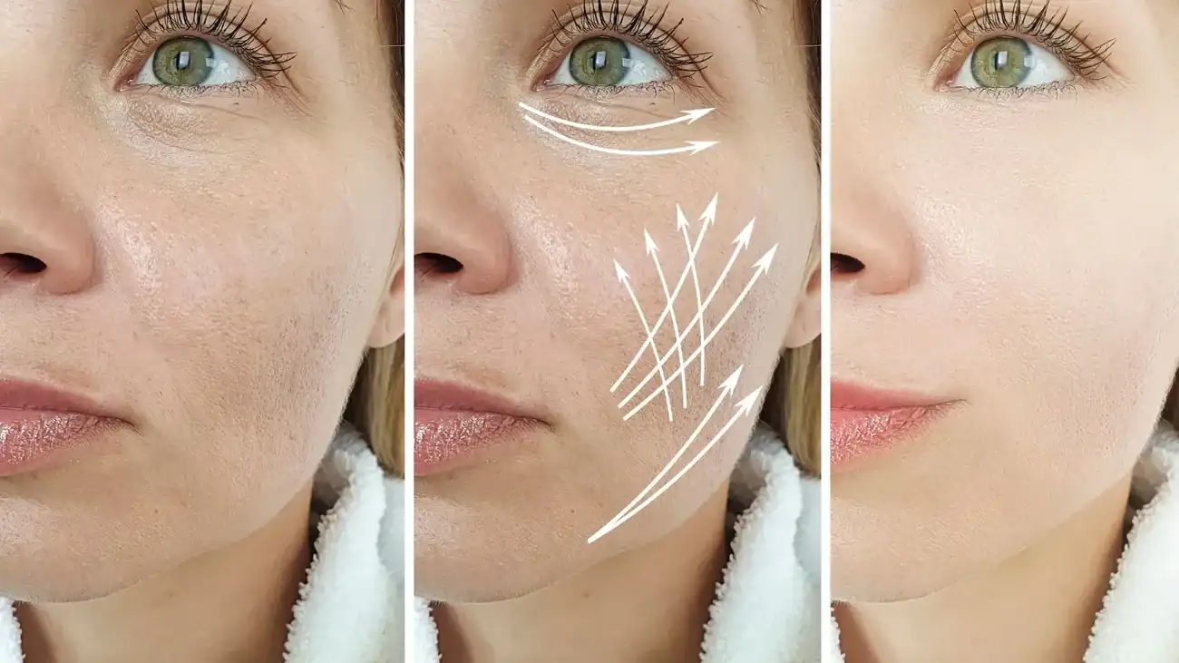 Can One Treatment Really Tackle More Than One Skin Concern Westminster?
