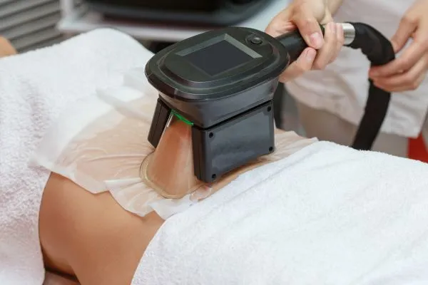 Image of person having fat freezing treatment to help weight gain Westminster