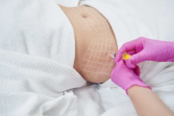 image of fat dissolving injections on love handles to help combat weight gain Westminster