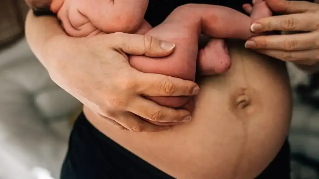 Why Is My Stomach Still Big After Pregnancy Westminster?